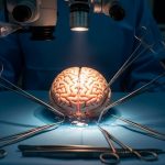 FDA Reversal Opens New Path for Huntington’s Gene Therapy After Official Ousted